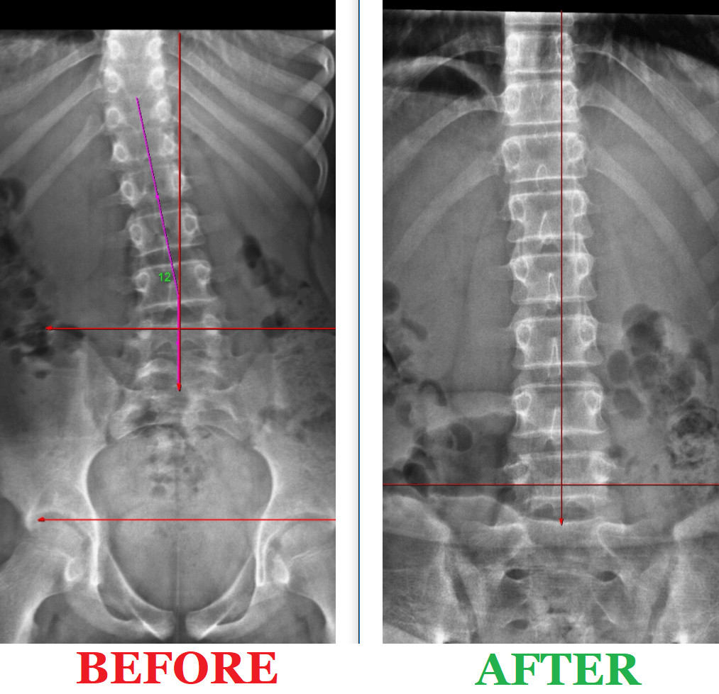 Graphic showing misalignment