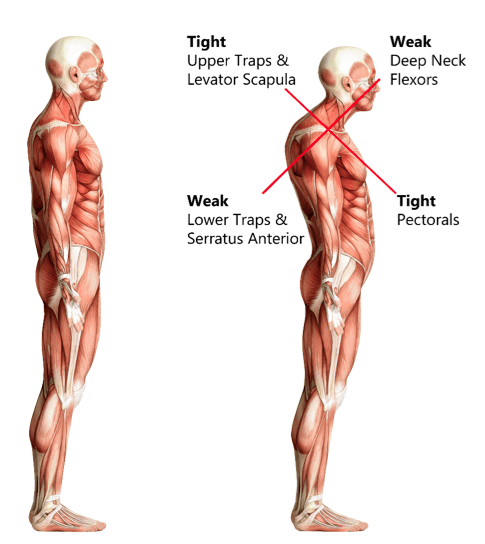 Spine posture graphic